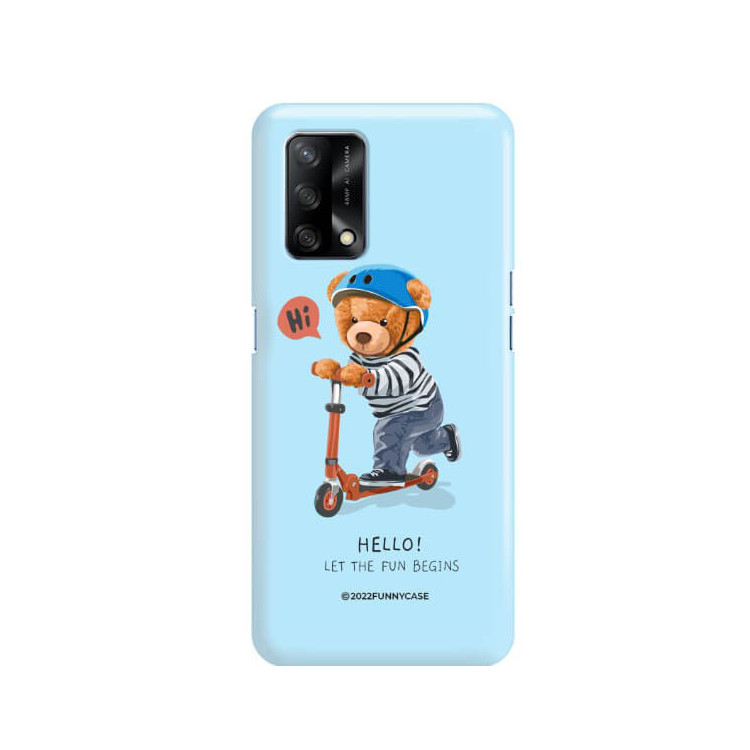 ETUI PROTECT CASE 2MM NA TELEFON OPPO A74 4GST_TEI-107 WIELOKOLOROWE