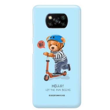 ETUI PROTECT CASE 2MM NA TELEFON XIAOMI POCO X3 NFCST_TEI-107 WIELOKOLOROWE