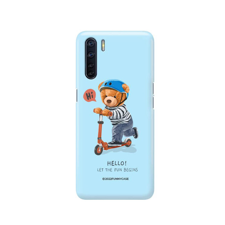 ETUI PROTECT CASE 2MM NA TELEFON OPPO A91 / RENO 3ST_TEI-107 WIELOKOLOROWE