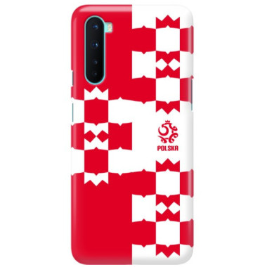 ETUI PROTECT CASE 2MM NA TELEFON ONEPLUS NORD  ST_PZPN_2022-101