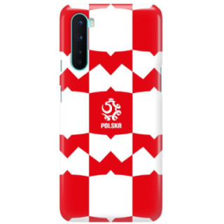 ETUI PROTECT CASE 2MM NA TELEFON ONEPLUS NORD  ST_PZPN_2022-103