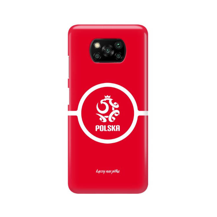 ETUI PROTECT CASE 2MM NA TELEFON XIAOMI POCO X3 / X3 PRO  ST_PZPN_2022-117